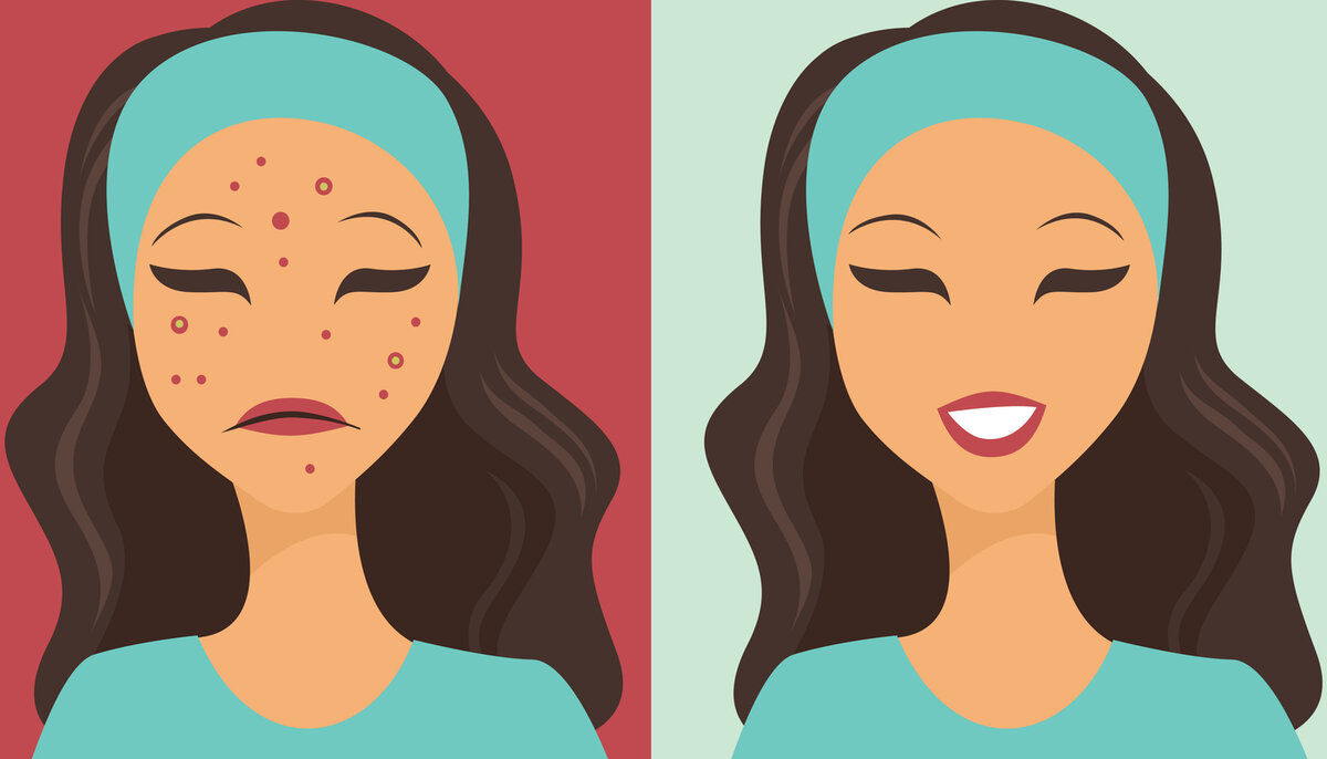 Взято с открытых источников Яндекс картинки