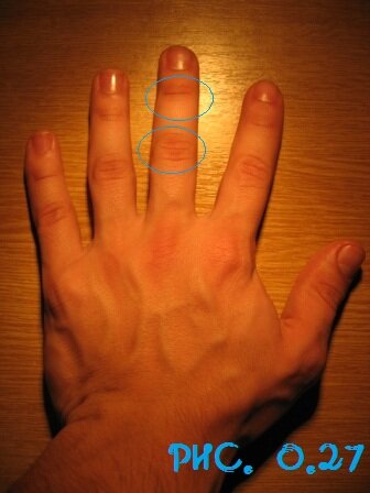 Гладкие суставы среднего пальца. 