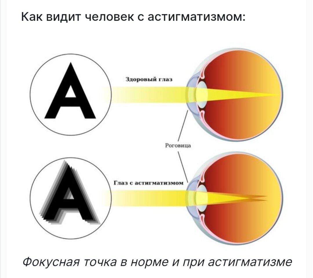 Сходили с дочкой (4,5г) к офтальмологу. 🏥 Или как Агния сама себя до слез  довела. 😅 | Растём вместе с детьми. Учу, играю, развиваю. 🤗 | Дзен