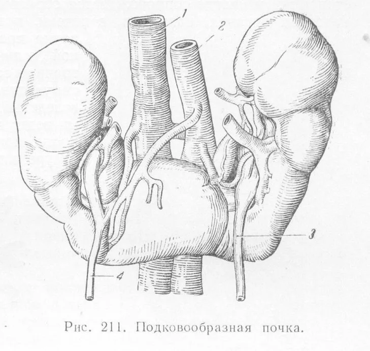 Увеличение 1 почки