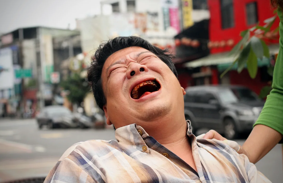 Нажевался бетеля до покраснения десен и смеется