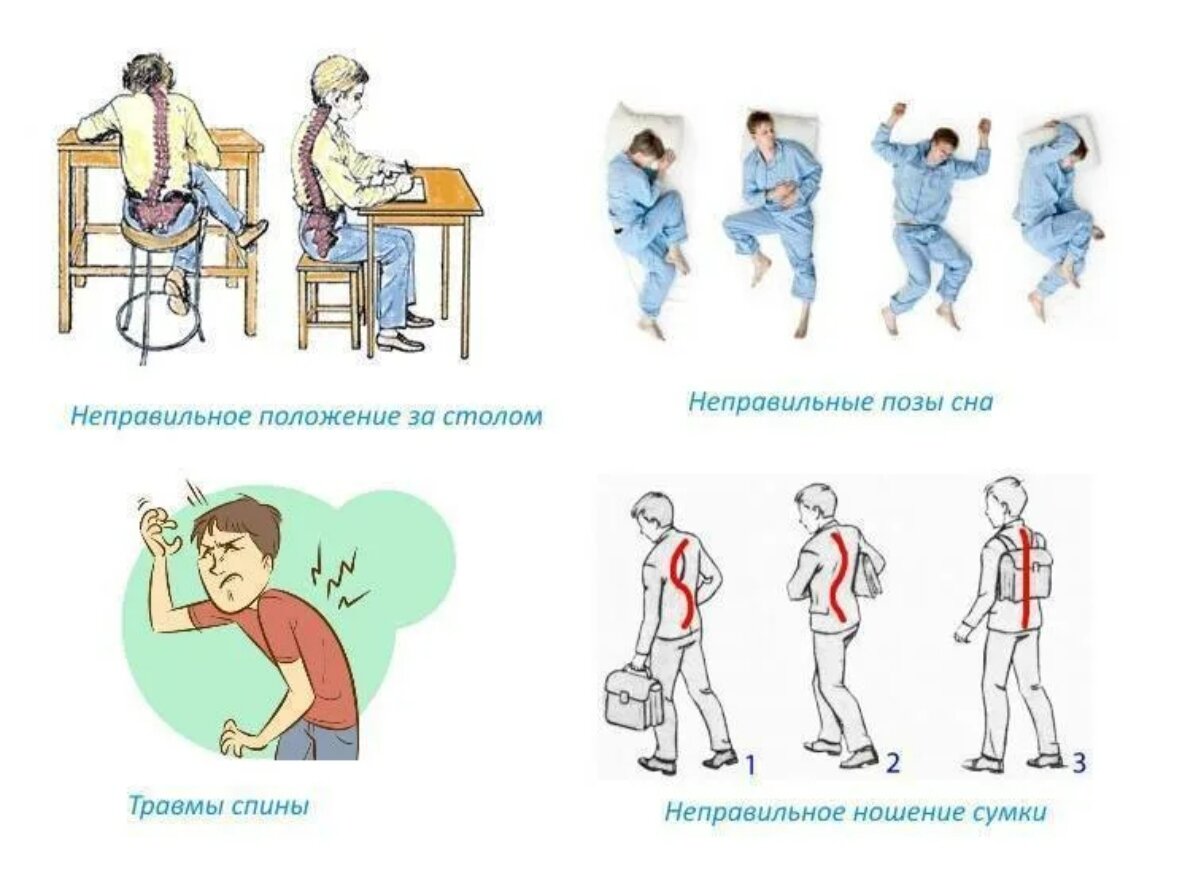 Искривления позвоночника встречающиеся у детей при несоответствии мебели их росту
