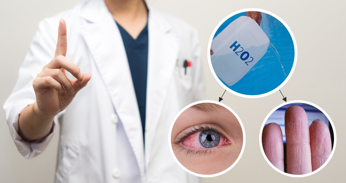 После обеззараживания воды в бассейне перекисью водорода пострадала вся семья