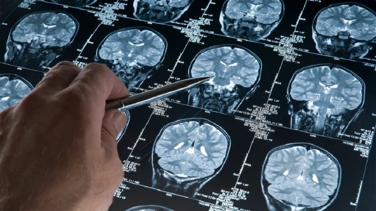 Можно ли улучшить память взрослому человеку?