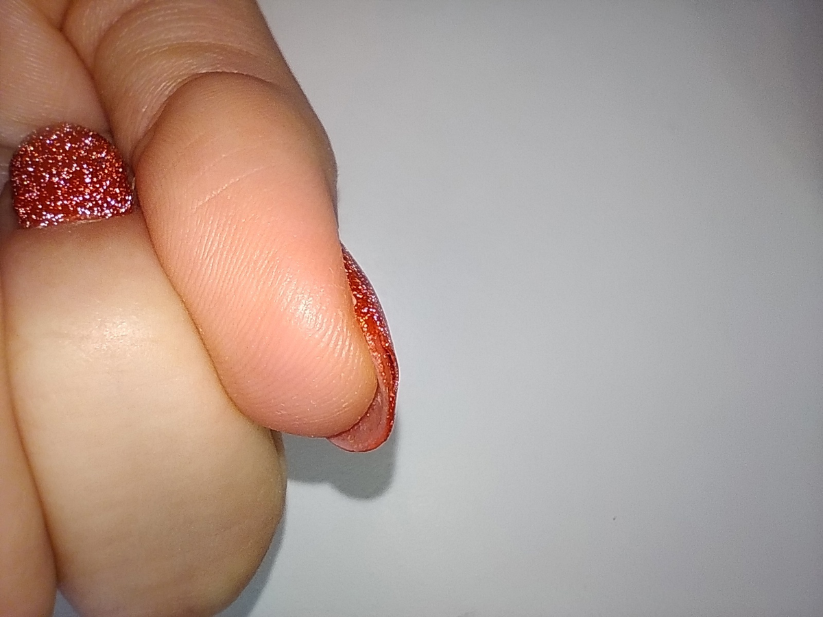 отслойка гель лака