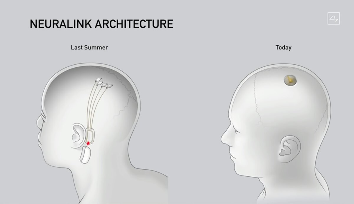 Схема изменений нейрочипа