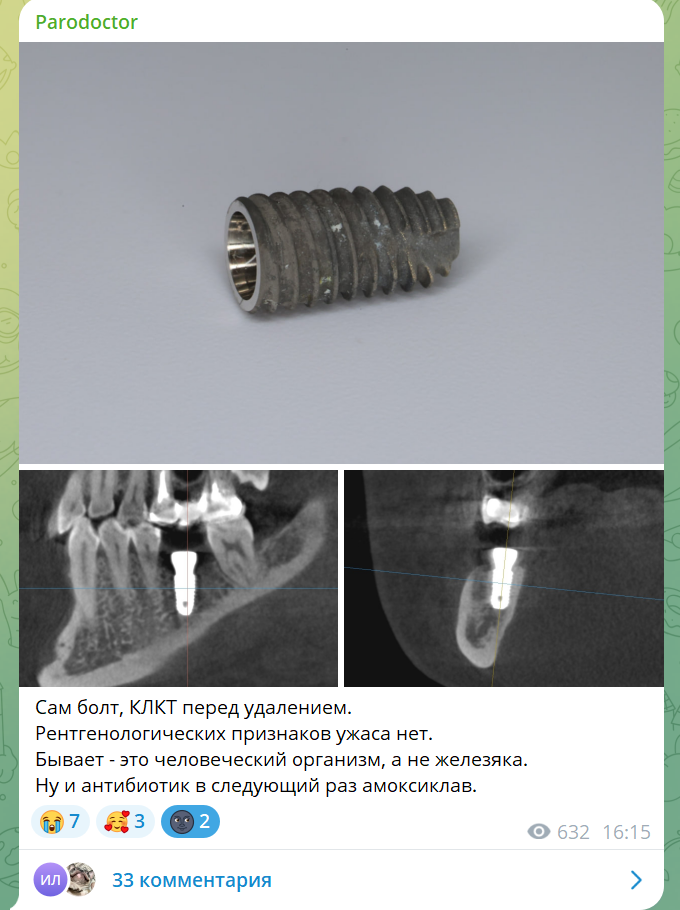Скрин из моего тг канала