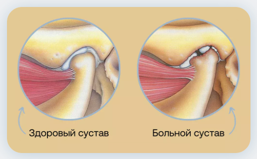 Лечение ВНЧС