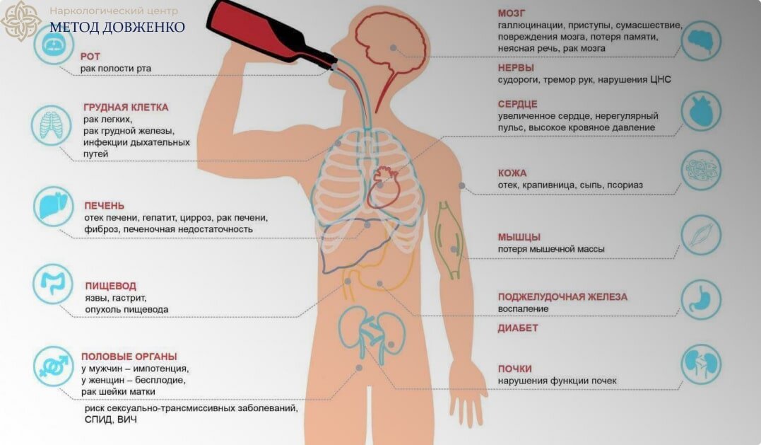 Причины болей в почках после алкоголя