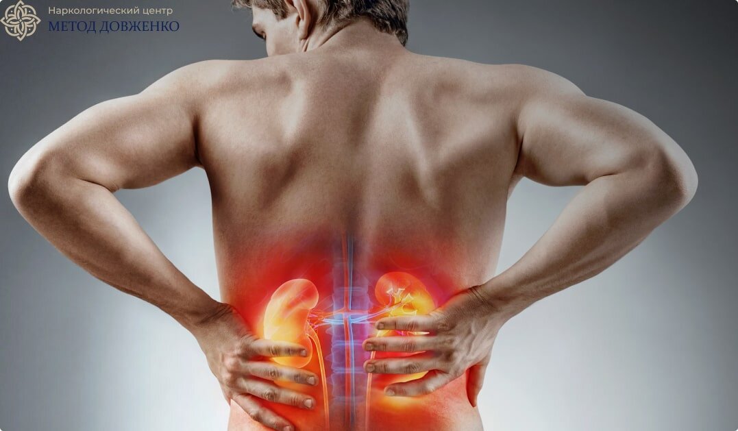 Максимальная доза алкоголя при камнях в почках