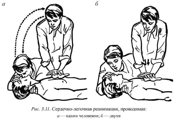 Сердечно-легочная реанимация выполняется. Сердечно-лёгочная реанимация. Сердечно-легочная реанимация одним спасателем. Проведение слр двумя спасателями. Сердечно легочной реанимации одним спасателем.