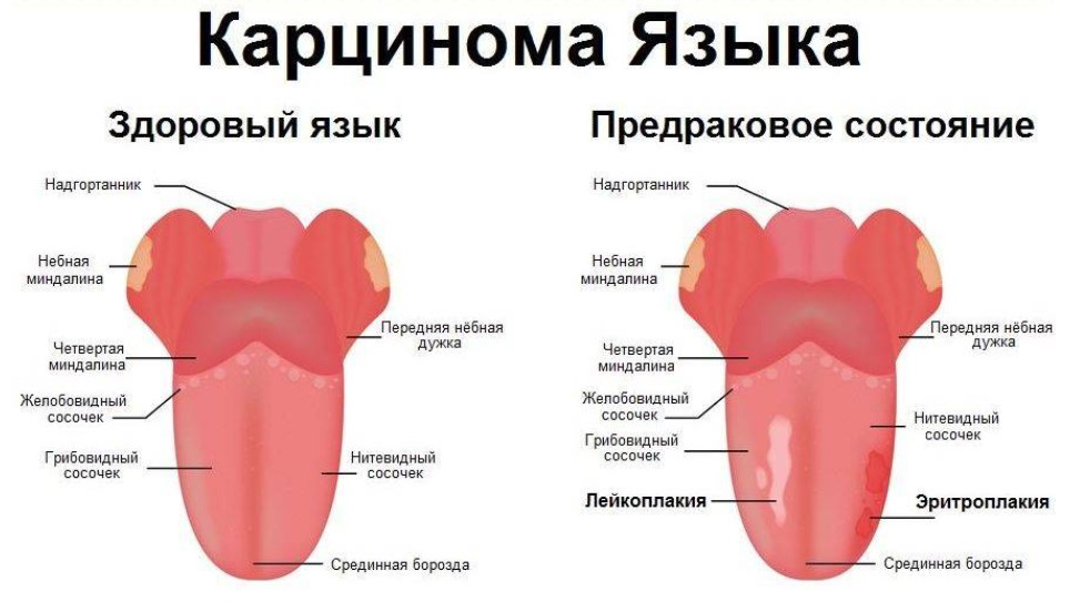 Язык холодный что это. Язык человека вкусовые рецепторы зоны. Язык холодный что это. Болезни по языку определить. Язык холодный что это.