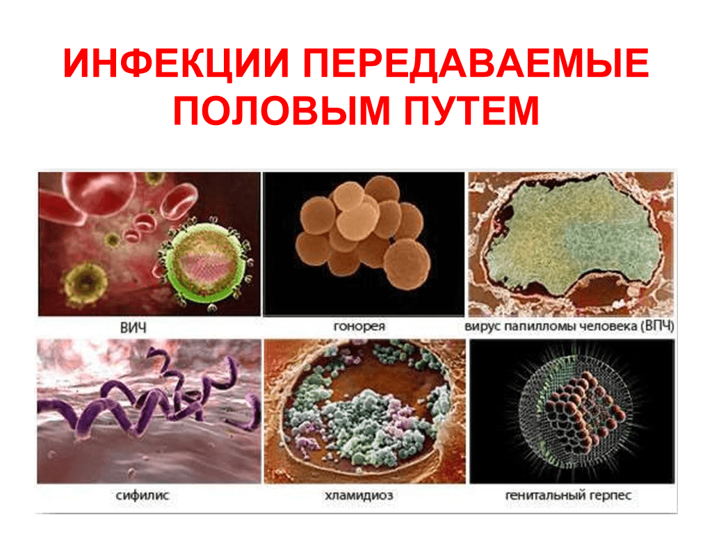 Половые инфекции у мужчин (ИППП, ЗППП): симптомы, запись к врачу