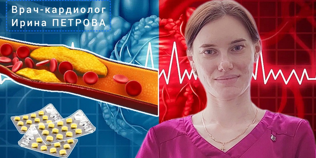 Могут ли статины привести к росту бляшек и закальцинировать их? Объясняет кардиолог Ирина ПЕТРОВА