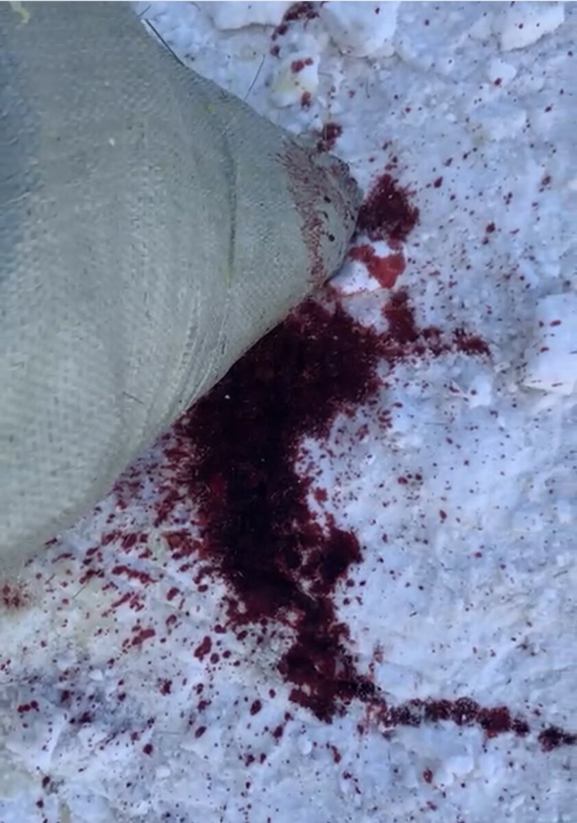 По виду это даже не моча, просто кровь