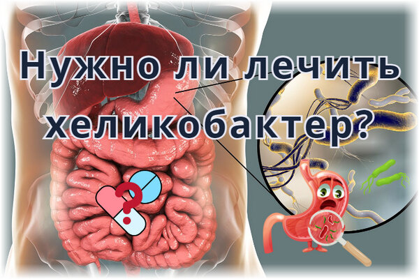 Лечение хеликобактерной инфекции: цены на лечение Helicobacter Pylori в Москве в ЛДЦ Кутузовский