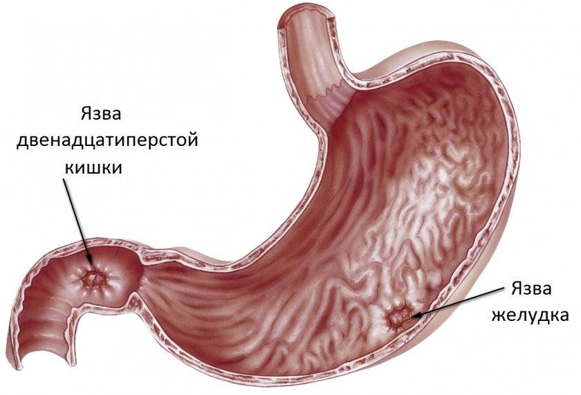 Какой врач лечит кишечник?