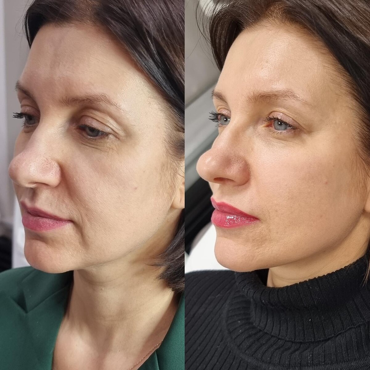 Эксперимент в Juvi Clinic