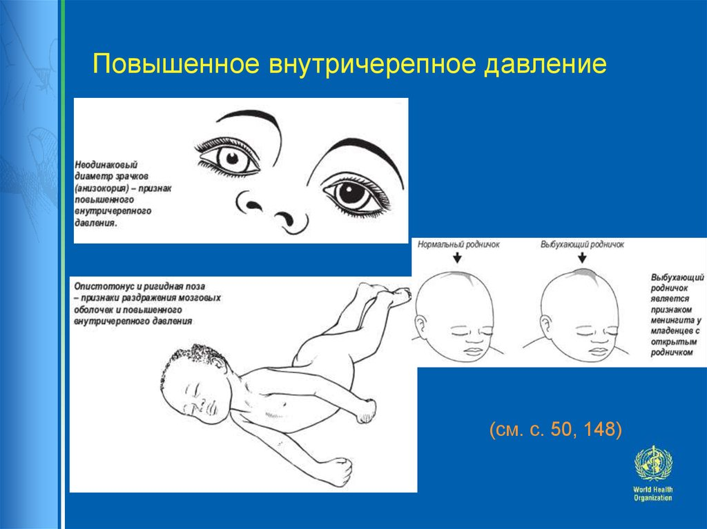 Внутричерепное давление