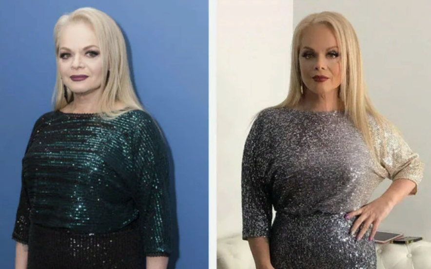 Лариса долина фото до и после