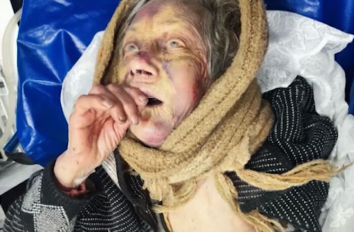 Источник фото: НТВ