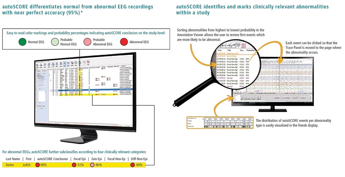 Natus autoSCORE for AI-enabled EEG Analysis