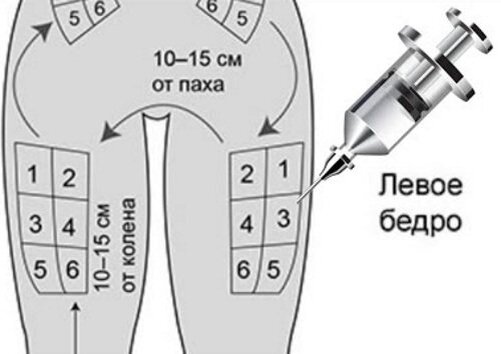 Как правильно делать укол в ягодицу