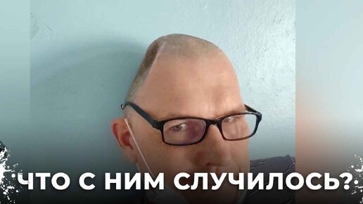 Лишился половины головы и теперь должен больше миллиона. Как ДТП изменило судьбу Тагильчанина