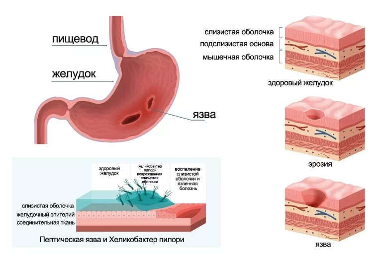 Пища для здоровья желудка