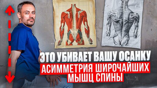 Download Video: Асимметрия широчайших мышц спины и ПРОБЛЕМЫ С ОСАНКОЙ — что делать? Массаж и тренировка