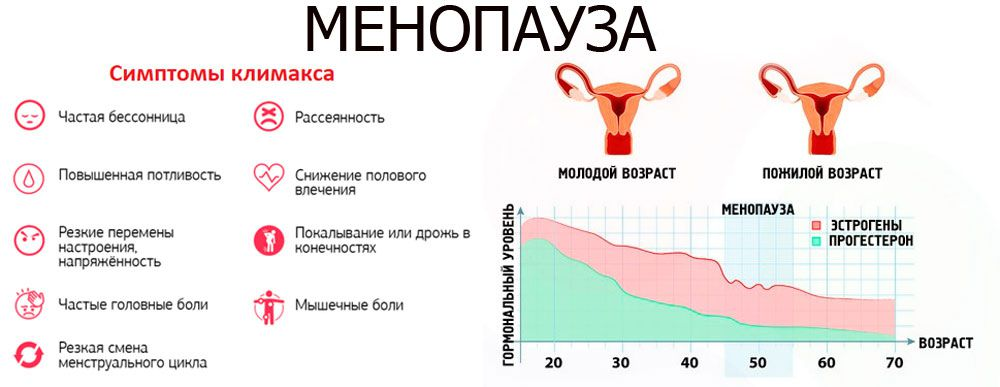 Гланый кошмар всех женщин - Его Величество Климакс: конец жизни или прекрасное начало?