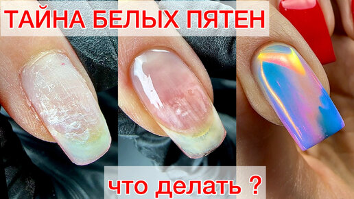 БЕЛЫЕ ПЯТНА НА НОГТЕ 🫣 ЧТО ЭТО ТАКОЕ? #nails #ногти #гельлак #manicure