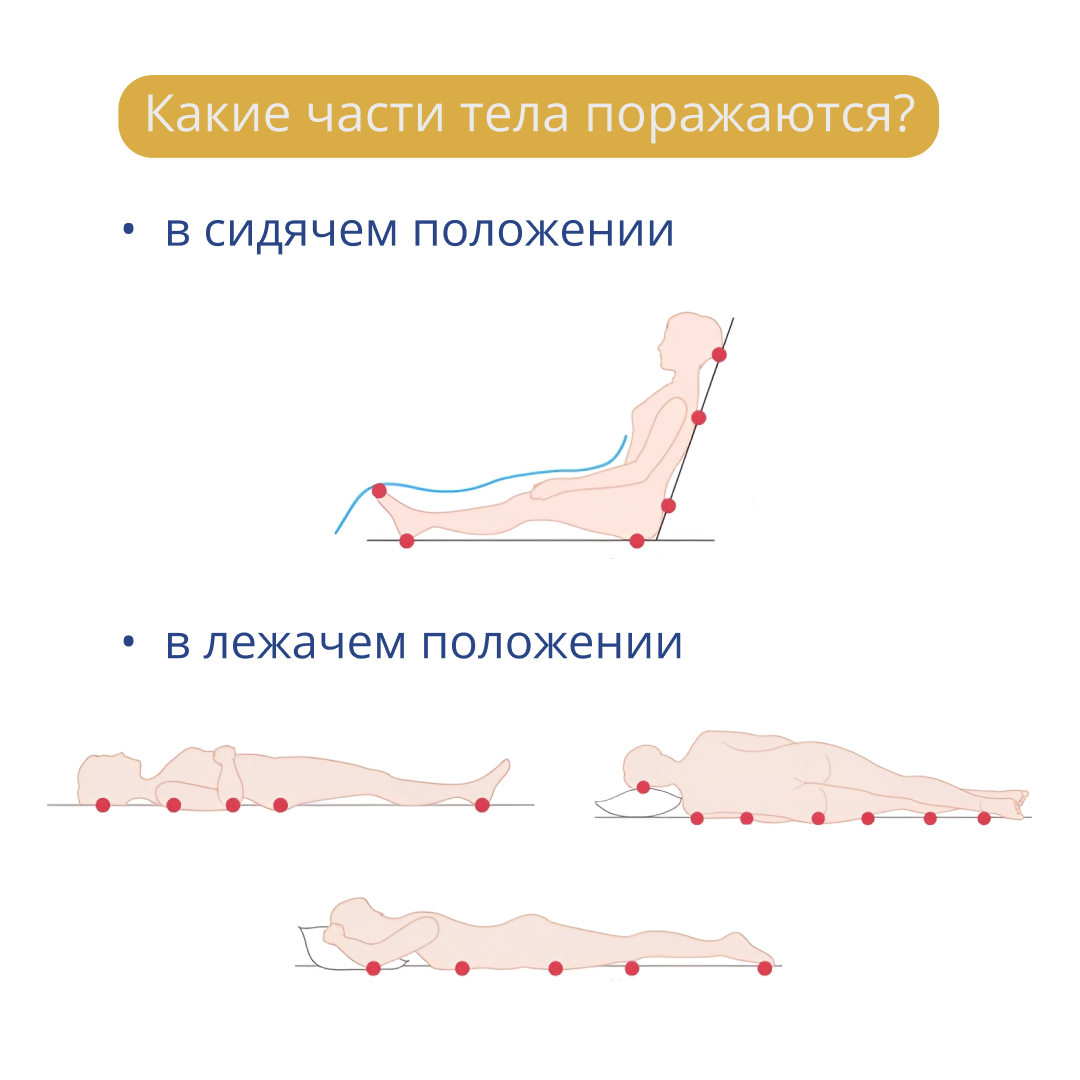 У всех пожилых 60+ риск пролежней, как этого избежать? | С заботой о  пожилых | Дзен