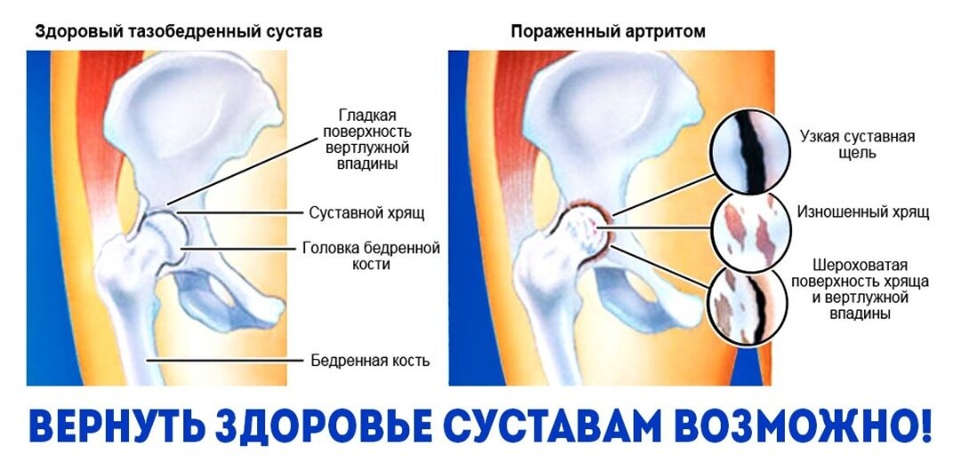 Центр тазобедренного сустава отзывы