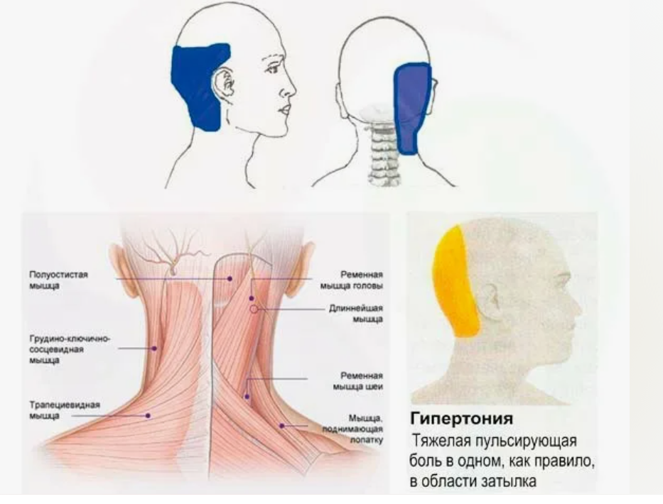 Почему давит на виски. Дискомфорт в затылочной части. Боль в голове с затылочной стороны.