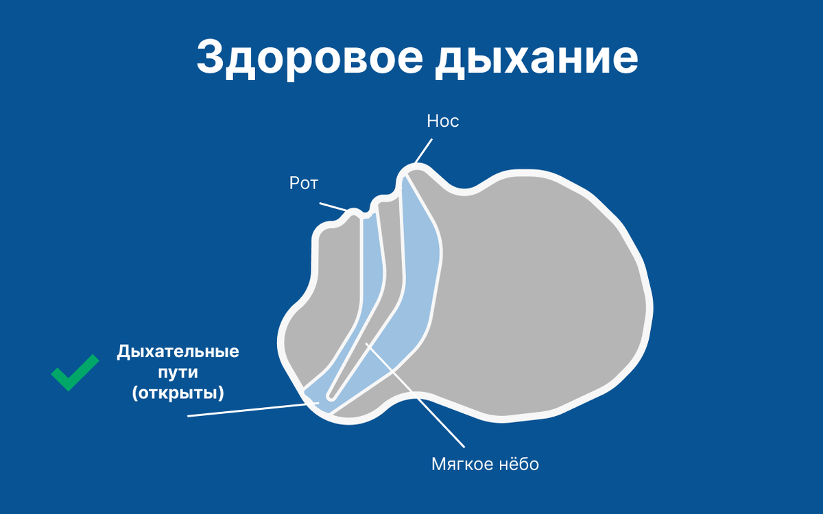 Наглядная разница между здоровым дыханием и храпом