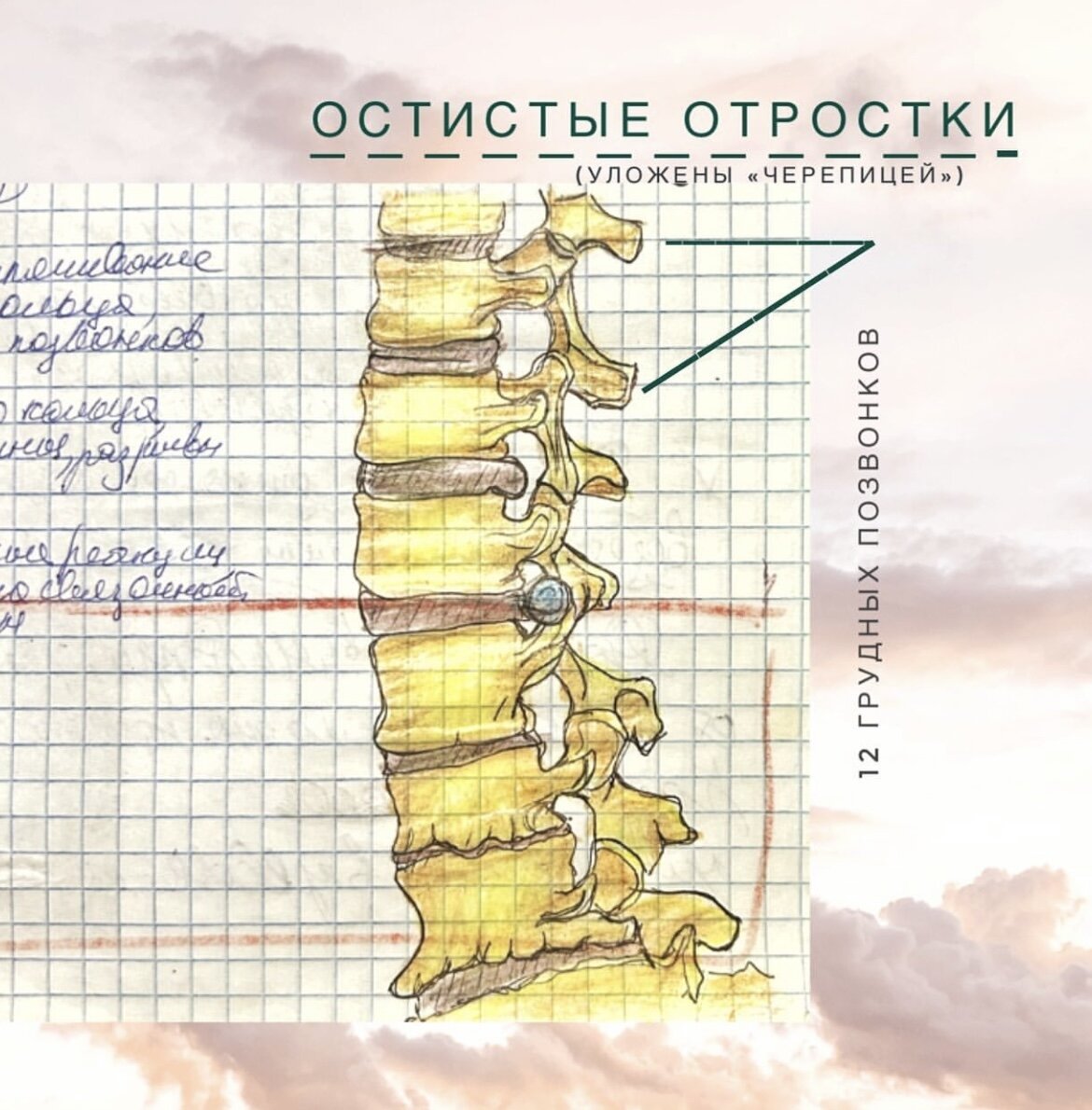 Решила добавить для наглядности мой старый рисунок из конспектов по циклу неврологии со времен учебы в медицинском ВУЗе. В верхней части мы видим переход из грудного отдела в поясничный, видна разница между более длинными, накрывающими друг друга как бы "черепицей" двумя верхними остистыми отростками грудного отдела (на них указывают зеленые указательные линии) и стоящими более свободно ниже остистыми отростками поясничного отдела. Чем выше мы будем подниматься по грудному отделу позвоночника, тем сильнее остистые отростки будут находить друг на друга.