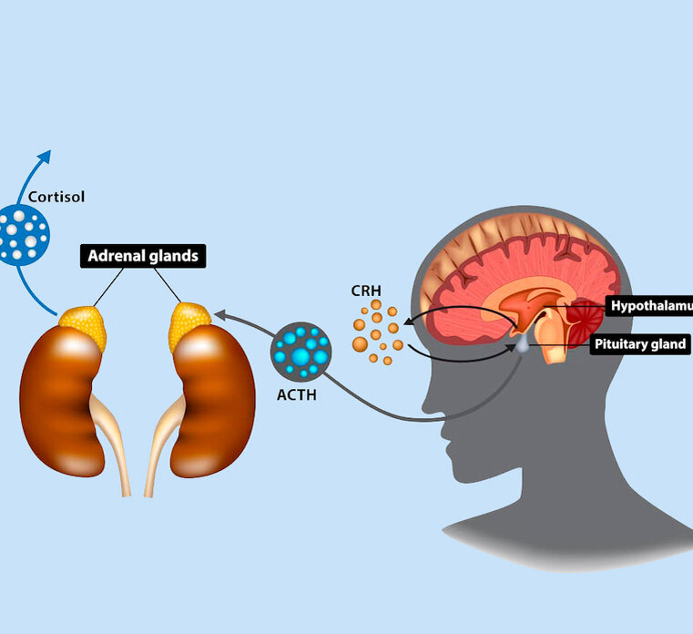 На сегодняшний день различные опухоли, в частности опухоли гипофиза, становятся все более распространенными, болезнь Кушинга напрямую связана с такими новообразовниями. Поэтому данная статья будет посвящена болезни Иценго-Кушинга. 