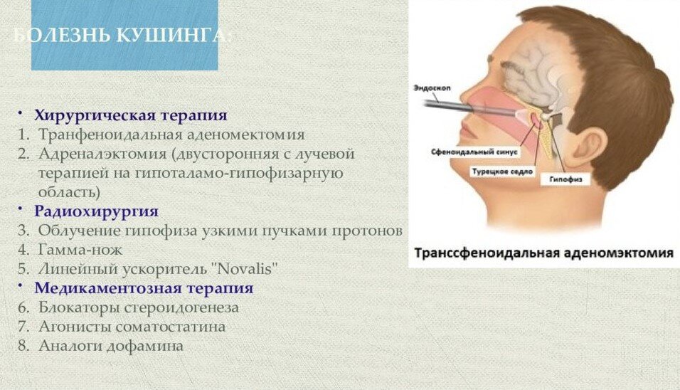 Синдром Иценко-Кушинга: что это за болезнь и как её лечить