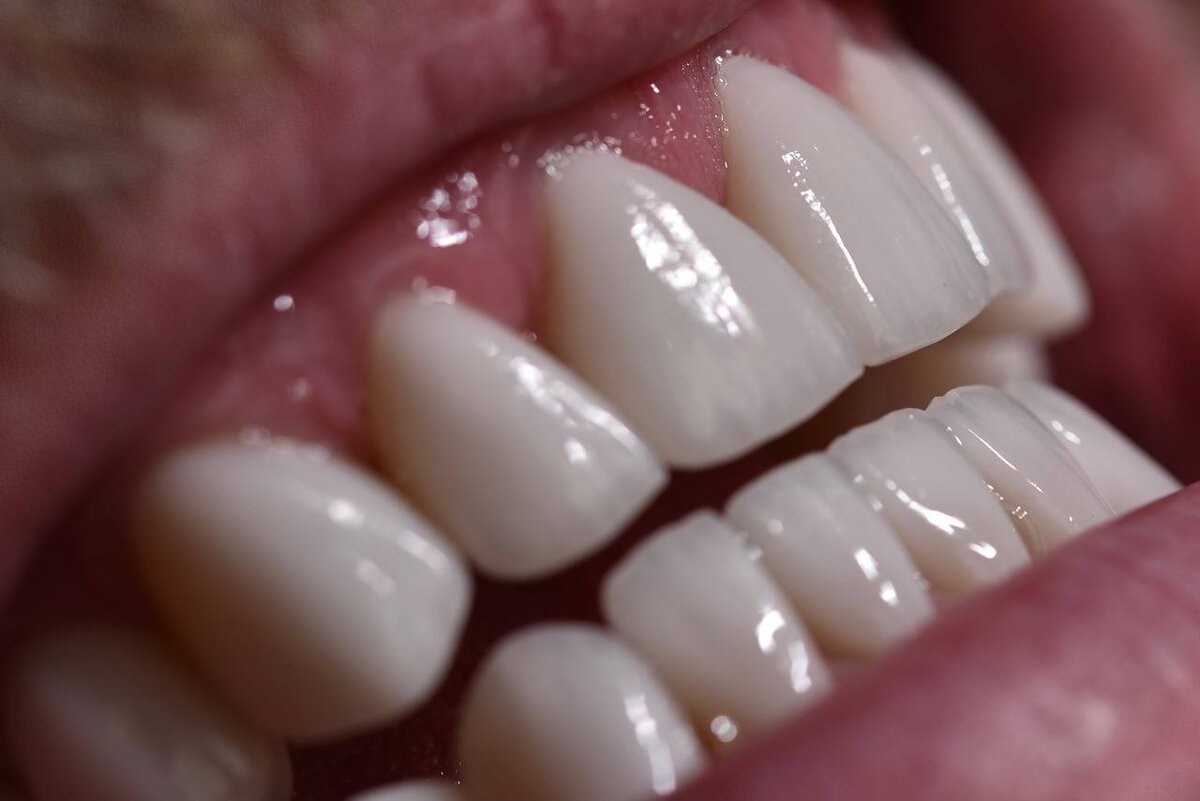 Работа наших стоматологов