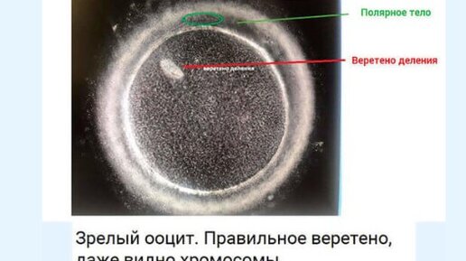 Оценка веретена деления яйцеклетки в ЭКО