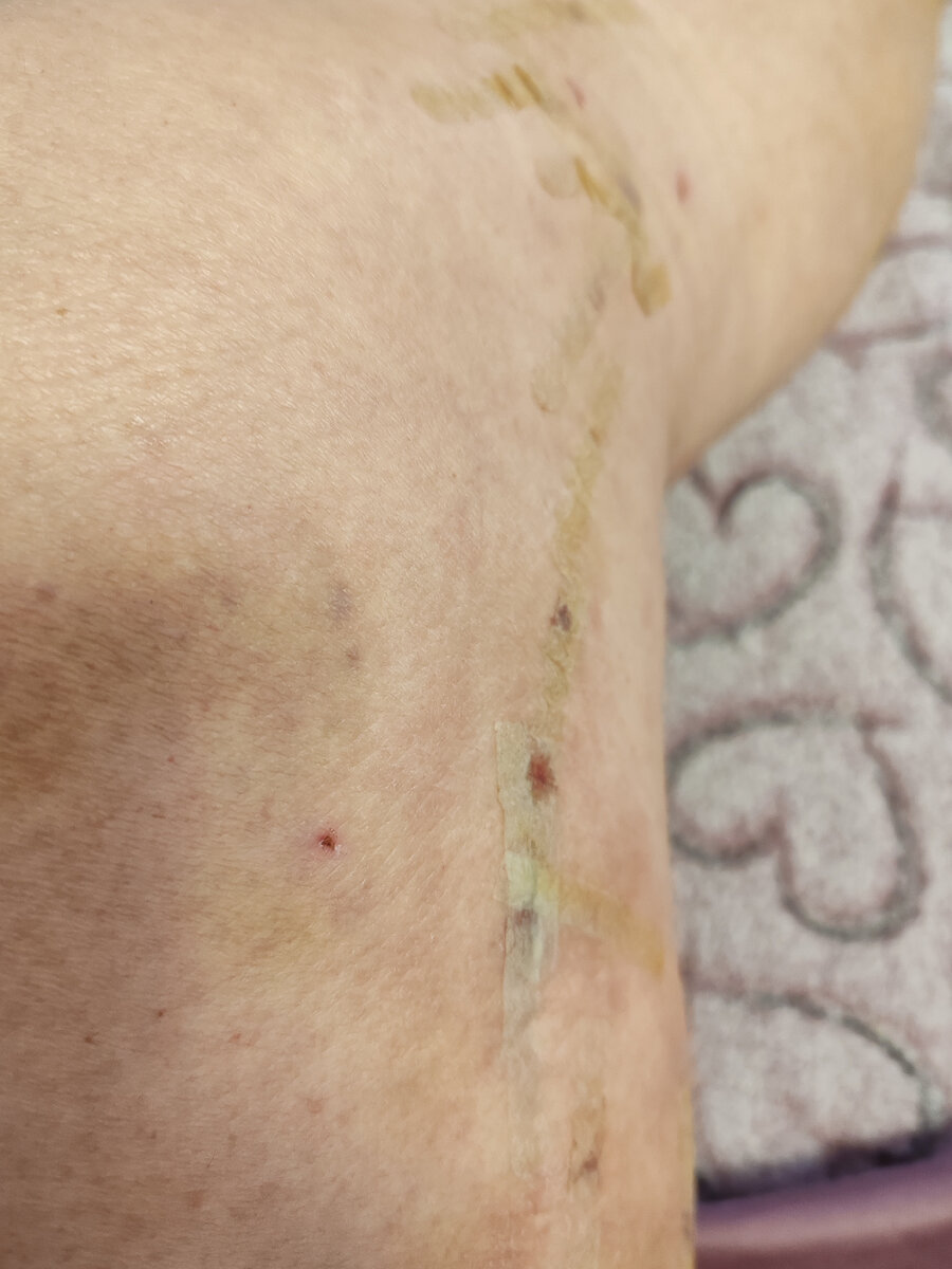 Сразу после операции Эвлк, можно сразу прогуляться в парке "Ривьера" городе-курорте Сочи. 