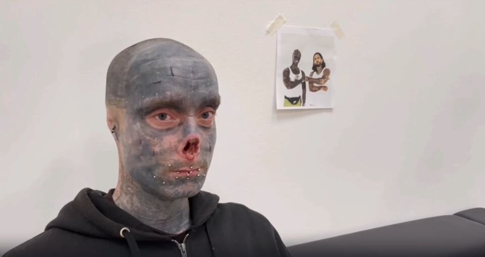    Калининградский "Зомби-бой". Источник: кадр видео "Sokolov laser / Удаление тату" на Rutube