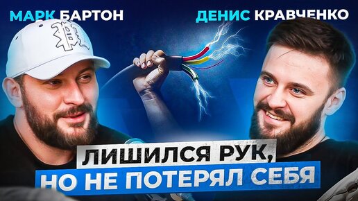 下载视频: Остался без рук в 12 лет — как сложилась жизнь? Денис Кравченко про несчастный случай и желание жить