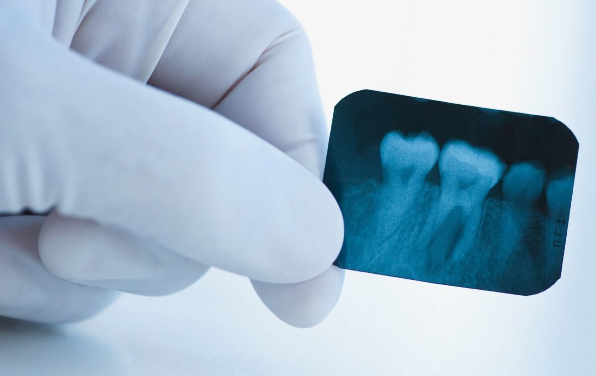 Прицельные снимки