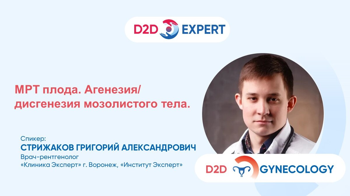 МРТ плода. Агенезия/ дисгенезия мозолистого тела. | D2D Expert | Дзен