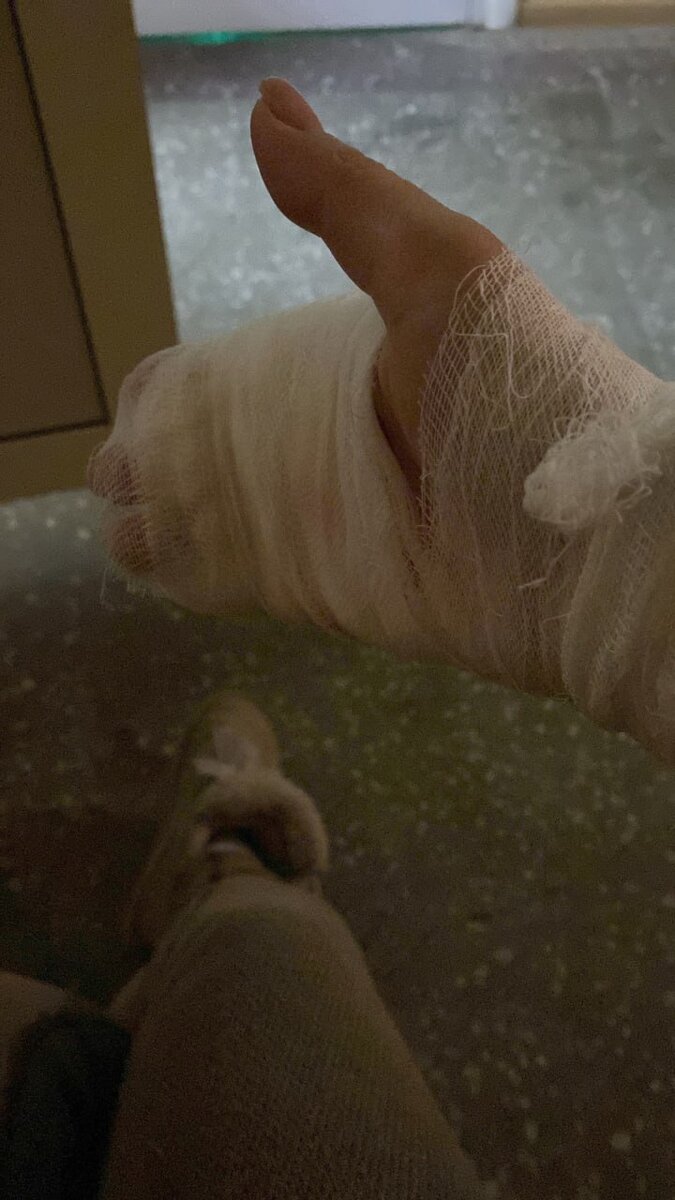 -2