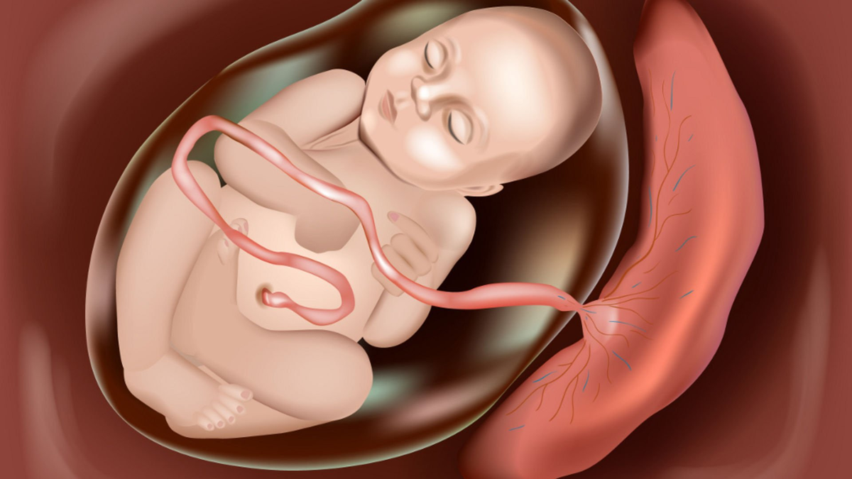 Короткая пуповина плода: чем опасна и какие могут быть последствия?