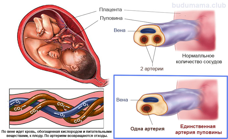 Обвития пуповиной - 30 ответов - Беременность - Форум Дети Mail