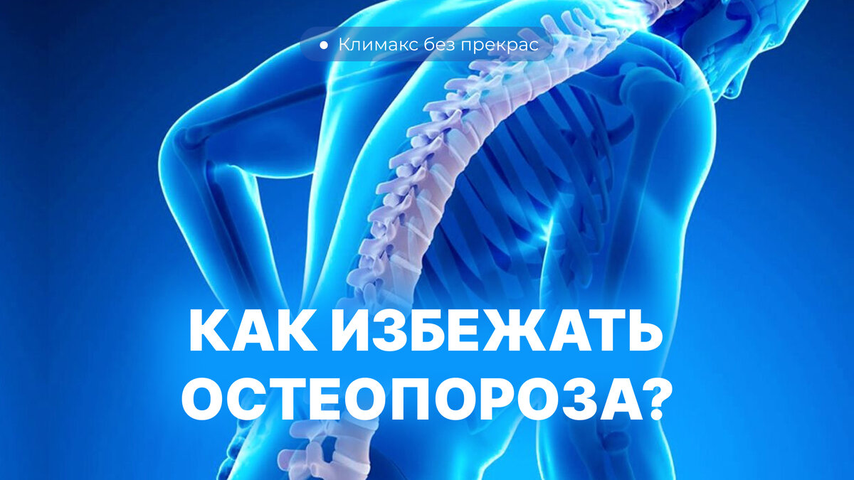 Как избежать остеопороза?